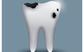 tooth, cavity