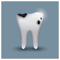 tooth, cavity