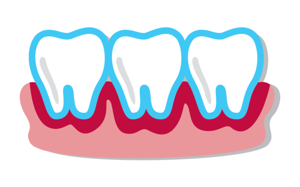 Bleeding Gums, Periodontal Disease