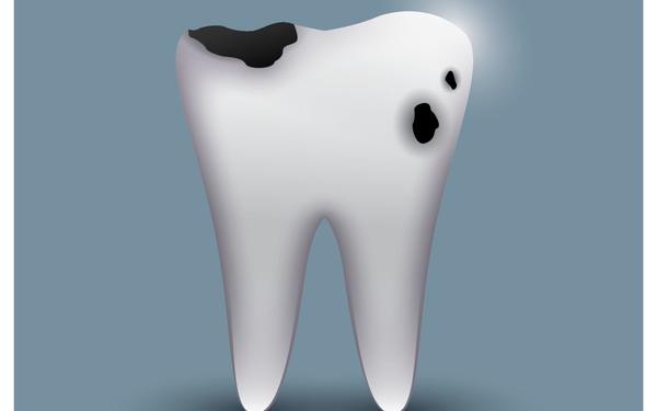 tooth, cavity