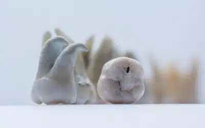 Why You Might Have a Cavity Without Even Knowing It