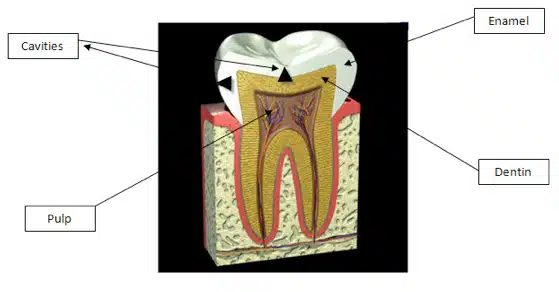 Cavities