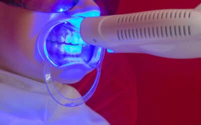 Crowns and Teeth Whitening