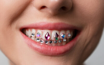 Tooth Gemstones: The Sparkling Smile Trend
