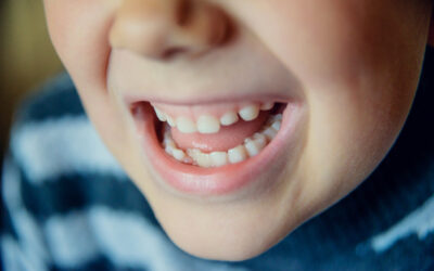 Understanding Tooth Eruption: A Guide for Parents