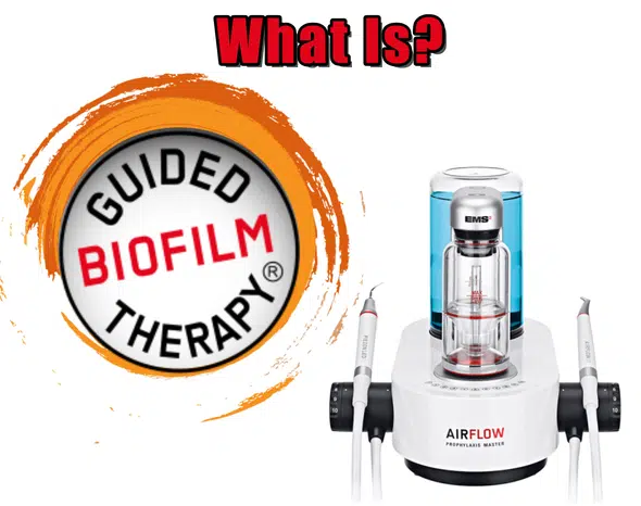 What Is Guided Biofilm Therapy (GBT)?