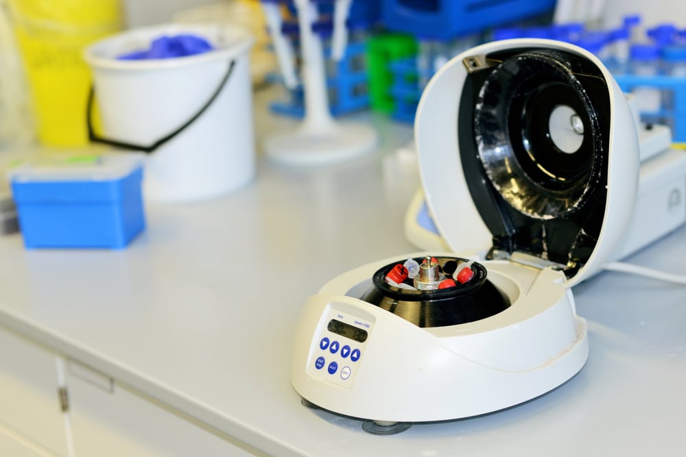 L-PRF Dental Healing: Natural, Fast Recovery After Oral Surgery