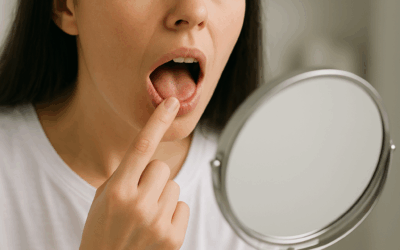 Oral Signs of Nutritional Deficiencies: What Your Mouth Says About Your Health