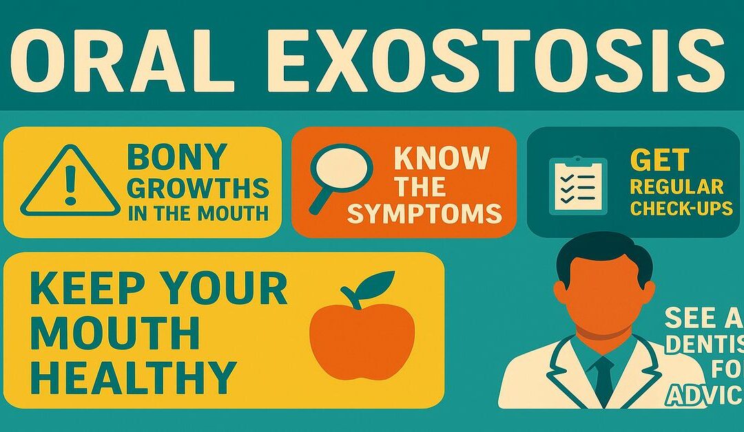 Horizontal infographic banner about oral exostosis, with icons highlighting bony growths in the mouth, key symptoms, and the importance of dental evaluation. Flat design in teal, orange, and white for use as a WordPress featured image.