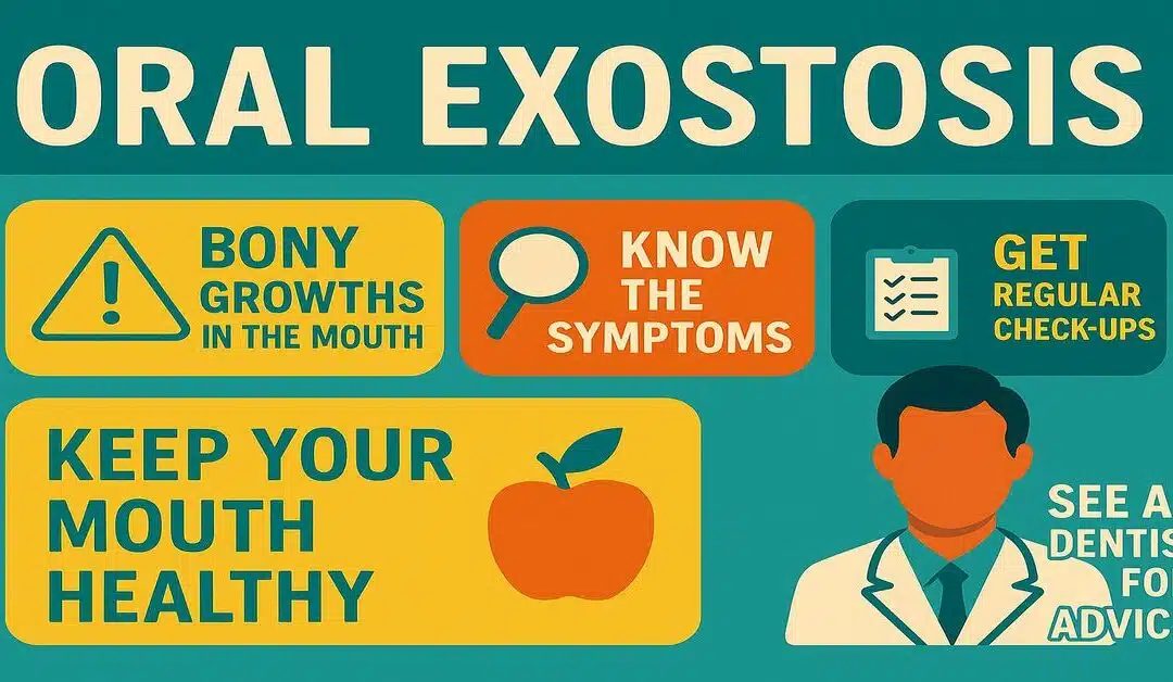 Top 5 Symptoms of Oral Exostosis You Shouldn’t Ignore