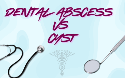 Tooth Abscess vs Cyst: 7 Key Warning Signs You Shouldn’t Ignore