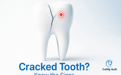 Cracked Tooth: Why It Happens, How to Spot It Early, and What to Do