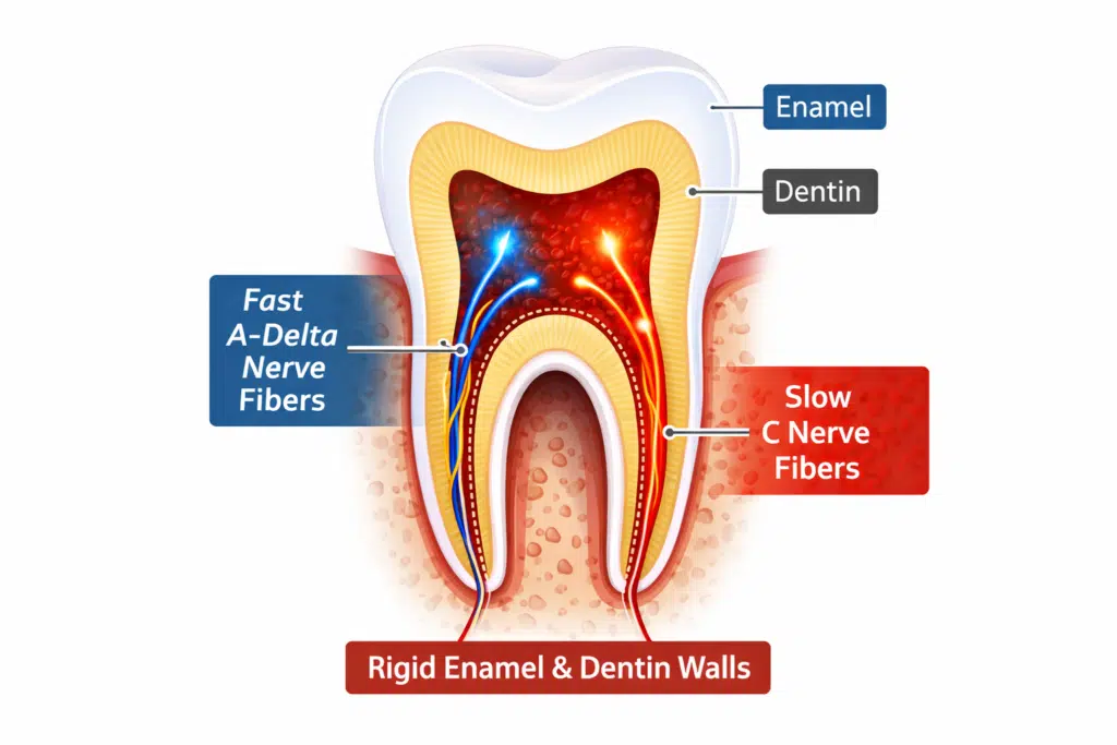 Illustration of inflamed tooth pulp showing A-delta and C nerve fibers surrounded by rigid enamel and dentin walls, explaining pressure buildup and severe toothache pain.